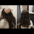 Hair Replacement  Singapore
